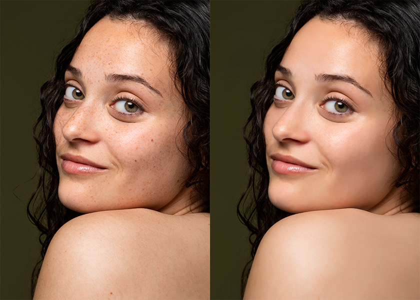 before-after image